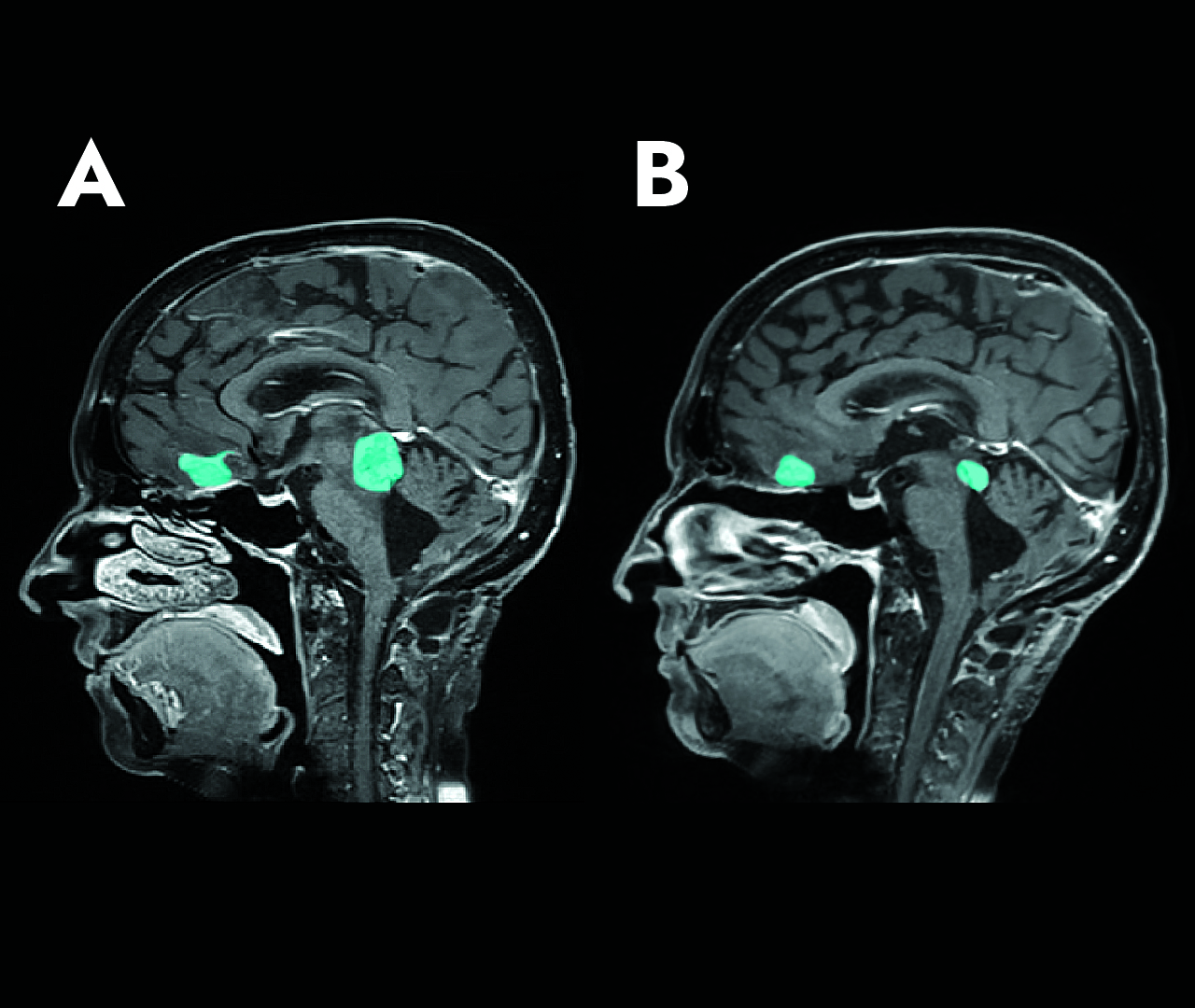 B&A Oncomedical unveils two innovative therapies for brain tumors